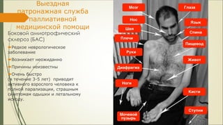 Боковой амиотрофический
склероз (БАС)
Редкое неврологическое
заболевание
Возникает неожиданно
Причины неизвестны
Очень быстро
(в течение 3-5 лет) приводит
активного взрослого человека к
полной парализации, страшным
симптомам одышки и летальному
исходу.
Выездная
патронажная служба
паллиативной
медицинской помощи
 