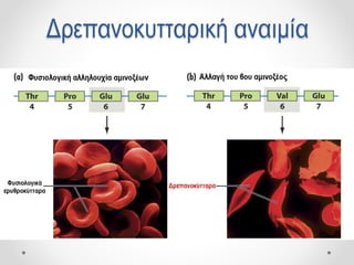 Δρεπανοκυτταρική αναιμία
 