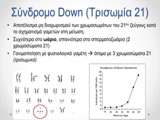 Σύνδρομο Down (Τρισωμία 21)
• Αποτέλεσμα μη διαχωρισμού των χρωμοσωμάτων του 21ου ζεύγους κατά
το σχηματισμό γαμετών στη μείωση.
• Συχνότερα στο ωάριο, σπανιότερα στο σπερματοζωάριο (2
χρωμοσώματα 21)
• Γονιμοποίηση με φυσιολογικό γαμέτη  άτομο με 3 χρωμοσώματα 21
(τρισωμικό)
 