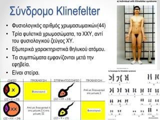 Σύνδρομο Klinefelter
• Φυσιολογικός αριθμός χρωμοσωμαικών(44)
• Τρία φυλετικά χρωμοσώματα, τα ΧΧΥ, αντί
του φυσιολογικού ζεύγος ΧΥ.
• Εξωτερικά χαρακτηριστικά θηλυκού ατόμου.
• Τα συμπτώματα εμφανίζονται μετά την
εφηβεία.
• Είναι στείρα.
 