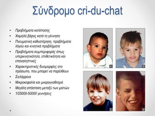 Σύνδρομο cri-du-chat
• Προβλήματα κατάποσης
• Χαμηλό βάρος κατά τη γέννηση
• Πνευματική καθυστέρηση, προβλήματα
λόγου και κινητικά προβλήματα
• Προβλήματα συμπεριφοράς όπως
υπερκινητικότητα, επιθετικότητα και
επαναληπτικές
• Χαρακτηριστικές δυσμορφίες στο
πρόσωπο, που μπορεί να παρέλθουν
• Σιελόρροια
• Μικροκεφαλία και μικρογναθισμό
• Μεγάλη απόσταση μεταξύ των ματιών
• 1/25000-50000 γεννήσεις
 