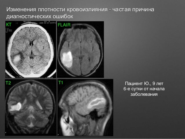 приказ 132 от 02.08.1991 с изменениями Выбор метода лучевой диагностики в неврологии.