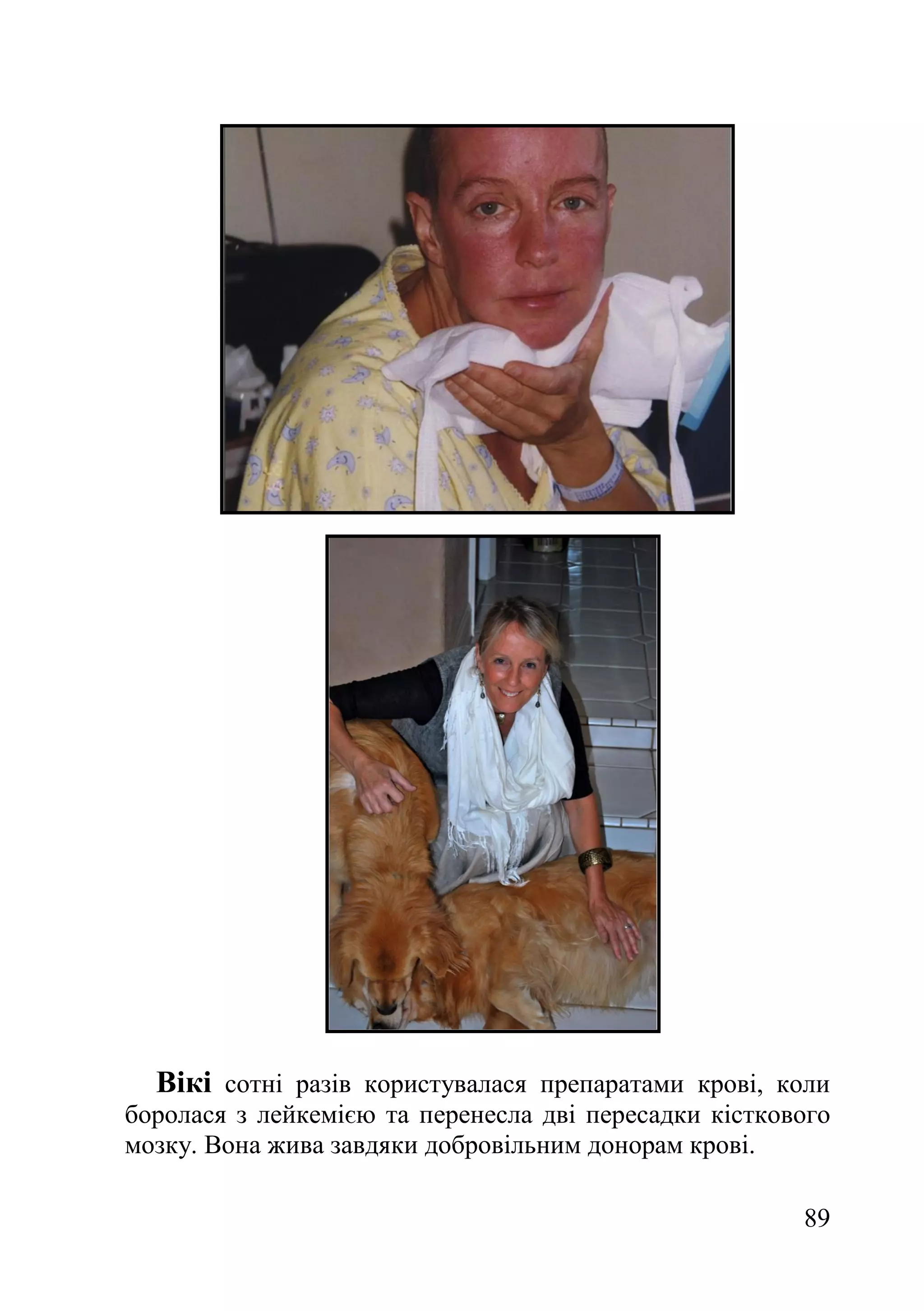 89
Вікі сотні разів користувалася препаратами крові, коли
боролася з лейкемією та перенесла дві пересадки кісткового
мозку. Вона жива завдяки добровільним донорам крові.
 