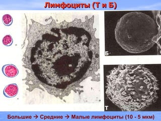 Лимфоциты (Т и Б)
Большие  Средние  Малые лимфоциты (10 - 5 мкм)
Б
Т
 