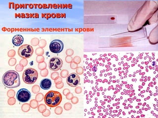 Приготовление
мазка крови
Форменные элементы крови
 