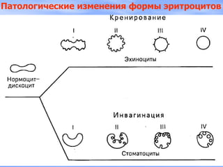 Патологические изменения формы эритроцитов
 