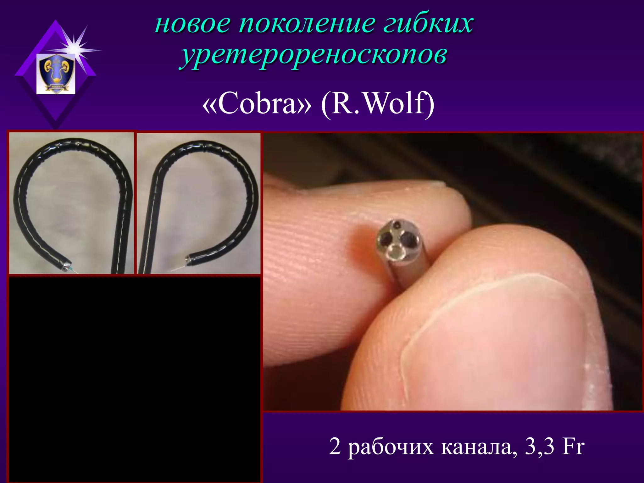 Инновации в лечении мкб | PPT | Free Download