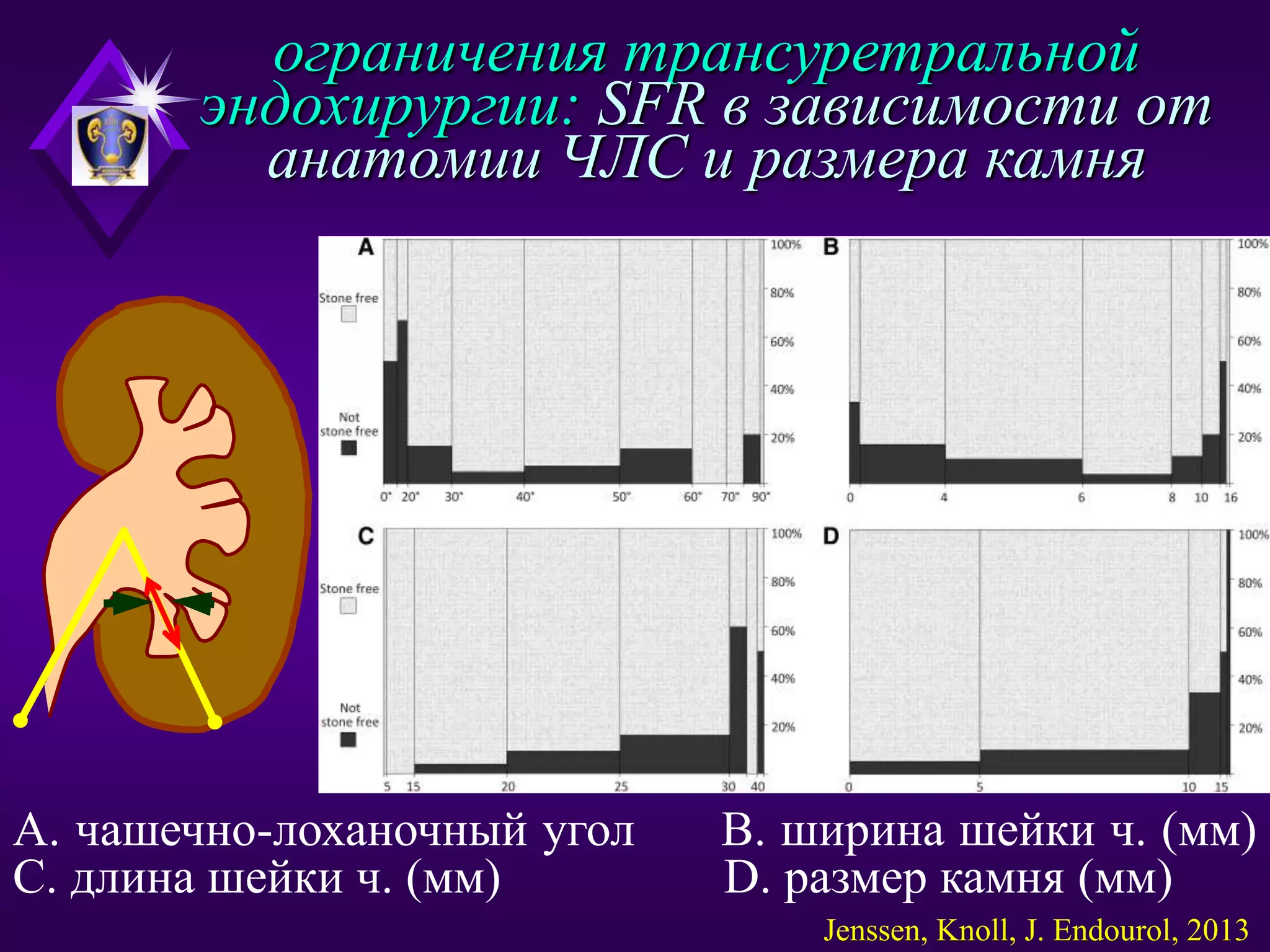Инновации в лечении мкб | PPT | Free Download