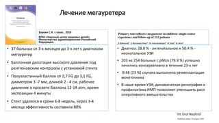 Лечение мегауретера
Зоркин С.Н. с соавт., 2016
ФГАУ «Научный центр здоровья детей»
Министерства здравоохранения Российской
Федерации.
• 37 больных от 3-х месяцев до 3-х лет с диагнозом
мегауретер
• Баллонная дилатация высокого давления под
рентгеновским контролем с установкой стента
• Полуэластичный баллон от 2,7 FG до 3,1 FG,
диаметром 3 -7 мм, длиной 2 - 4 см, рабочее
давление в просвете баллона 12-14 atm, время
экспозиции 4 минуты
• Стент удалялся в сроки 6-8 недель, через 3-4
месяца эффективность составила 80%
• Диагноз: 28.8 % - антенатальное и 50.4 % -
неонатальное УЗИ
• 203 из 254 больных с pMUs (79.9 %) успешно
лечились консервативно в течение 23-х лет
• В 48 (23 %) случаях выполнена реимплантация
мочеточника
• В наше время УЗИ, динамическая ренография и
профилактика ИМП позволяют уменьшить риск
оперативного вмешательства
Int Urol Nephrol
 