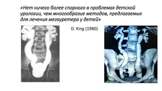 «Нет ничего более спорного в проблемах детской
урологии, чем многообразие методов, предлагаемых
для лечения мегауретера у детей»
D. King (1980)
 