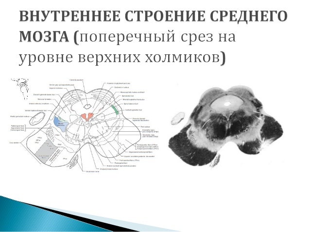 Центр зрения око сарапул