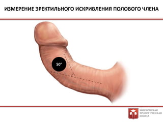 необрезаный член