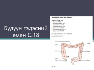 Бүдүүн гэдэсний
өмөн С.18
 