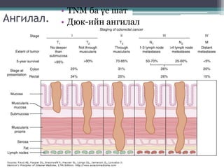 Ангилал.
• TNM ба үе шат
• Дюк-ийн ангилал
 