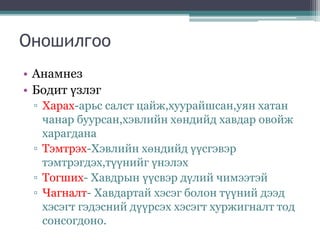 Оношилгоо
• Анамнез
• Бодит үзлэг
▫ Харах-арьс салст цайж,хуурайшсан,уян хатан
чанар буурсан,хэвлийн хөндийд хавдар овойж
харагдана
▫ Тэмтрэх-Хэвлийн хөндийд үүсгэвэр
тэмтрэгдэх,түүнийг үнэлэх
▫ Тогших- Хавдрын үүсвэр дүлий чимээтэй
▫ Чагналт- Хавдартай хэсэг болон түүний дээд
хэсэгт гэдэсний дүүрсэх хэсэгт хуржигналт тод
сонсогдоно.
 