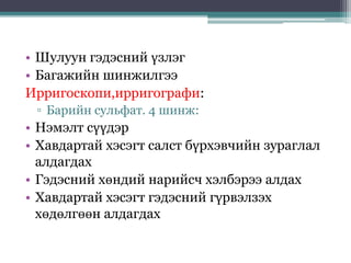 • Шулуун гэдэсний үзлэг
• Багажийн шинжилгээ
Ирригоскопи,ирригографи:
▫ Барийн сульфат. 4 шинж:
• Нэмэлт сүүдэр
• Хавдартай хэсэгт салст бүрхэвчийн зураглал
алдагдах
• Гэдэсний хөндий нарийсч хэлбэрээ алдах
• Хавдартай хэсэгт гэдэсний гүрвэлзэх
хөдөлгөөн алдагдах
 