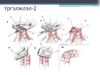 Үргэлжлэл-2
 