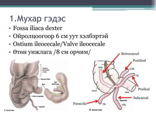 1.Мухар гэдэс
• Fossa iliaca dexter
• Ойролцоогоор 6 см уут хэлбэртэй
• Ostium ileocecale/Valve ileocecale
• Өтөн унжлага /8 см орчим/ Retrocaecal
Postileal
Preileal
Subcaecal
Paracolic
 