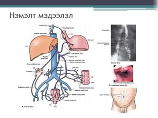 Нэмэлт мэдээлэл
 