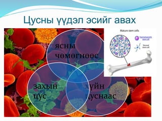 Цусны үүдэл эсийг авах
ясны
чөмөгнөөс
хүйн
цуснаас
захын
цус
 