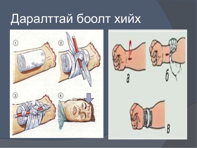 цус алдалтыг тогтоох