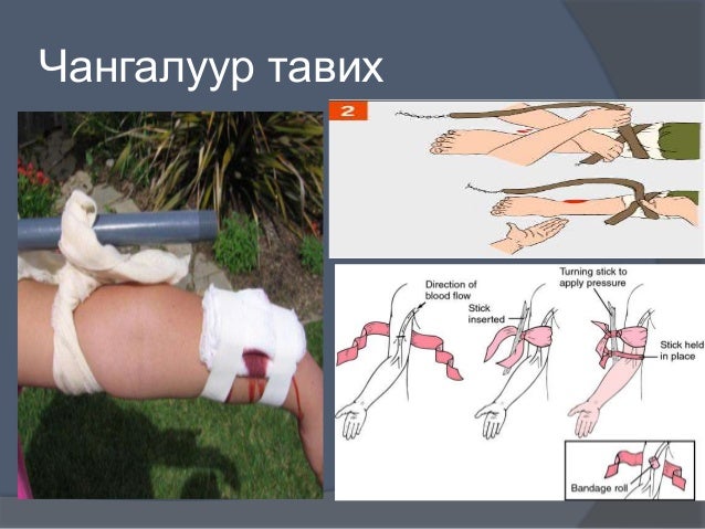 цус алдалтыг тогтоох