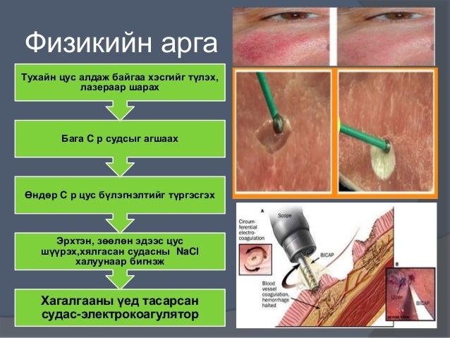 цус алдалтыг тогтоох