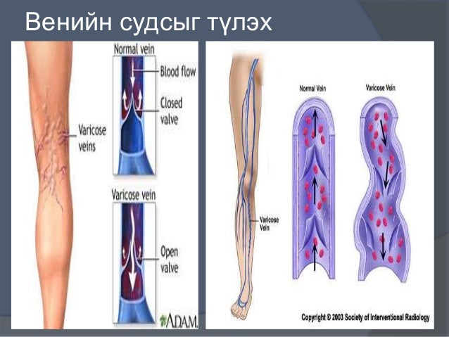 цус алдалтыг тогтоох