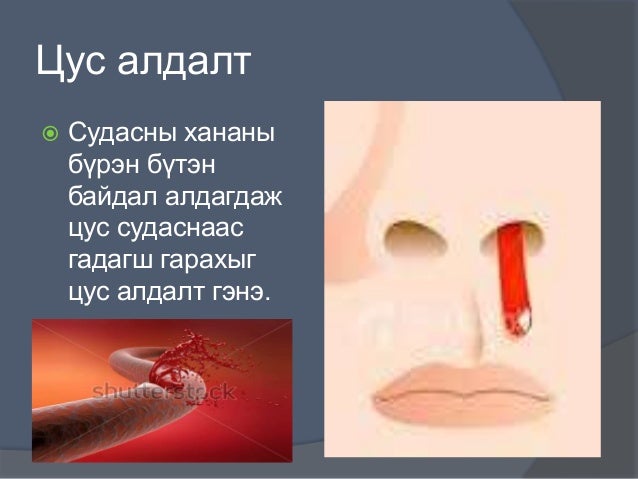 цус алдалтыг тогтоох