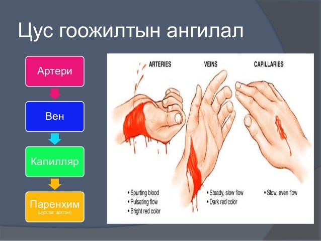 цус алдалтыг тогтоох