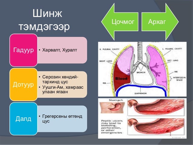 цус алдалтыг тогтоох