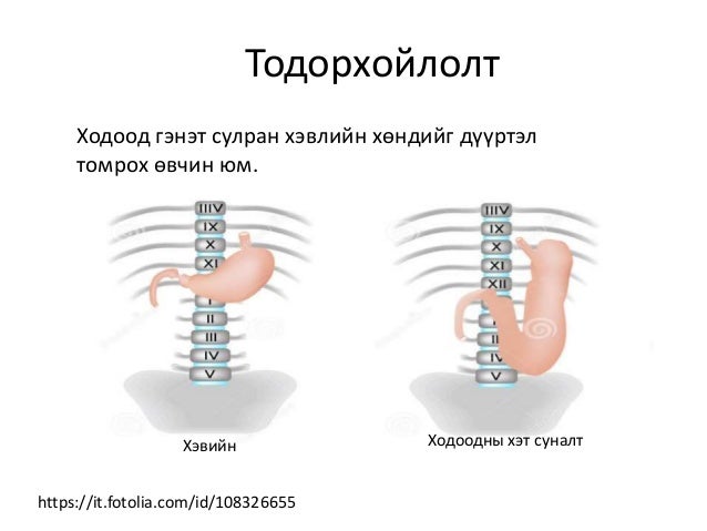 ходоодны хэт-суналт