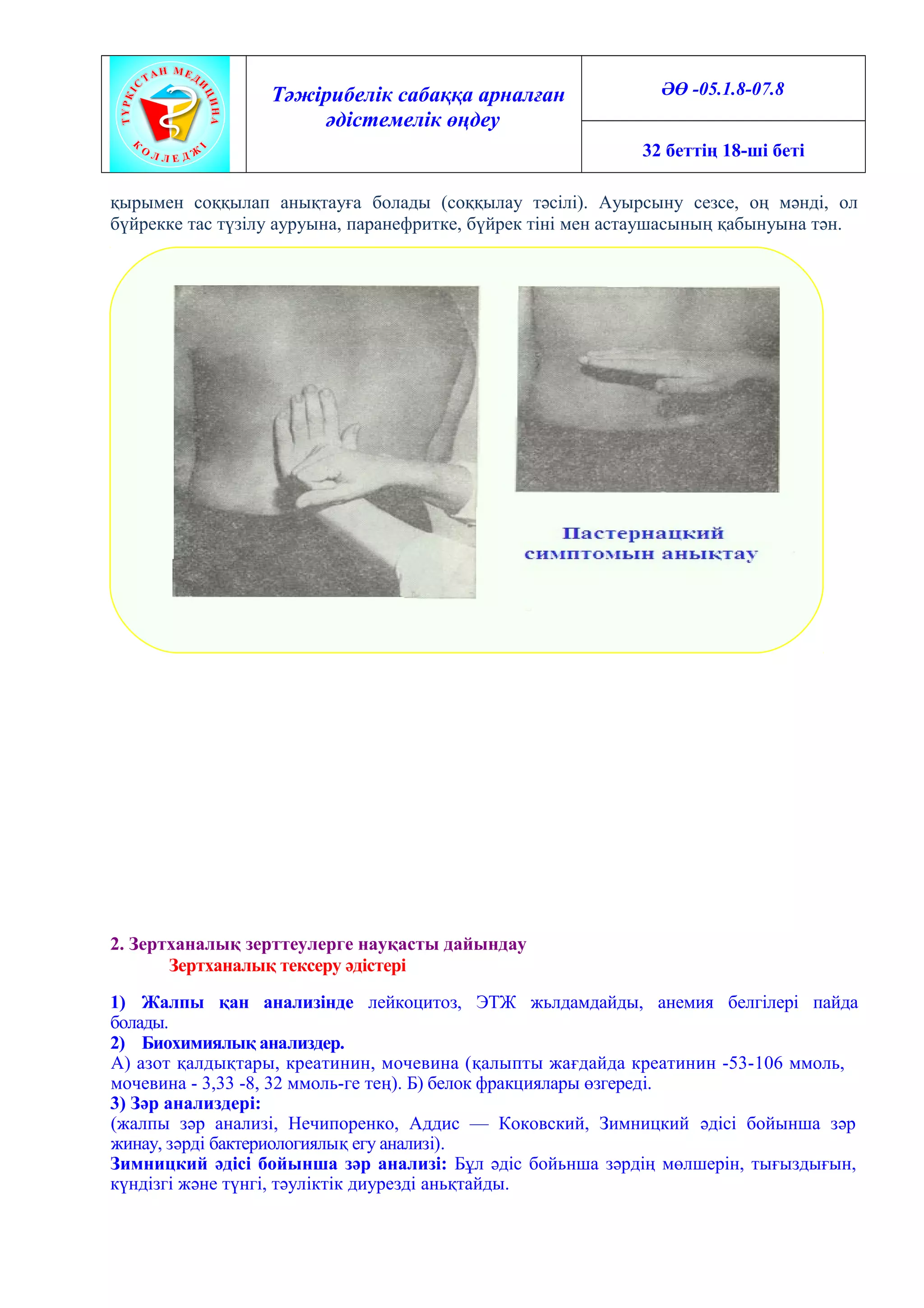 Төмендегі киска оны жалауға мүмкіндік береді