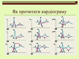 Як прочитати кардіограму
 