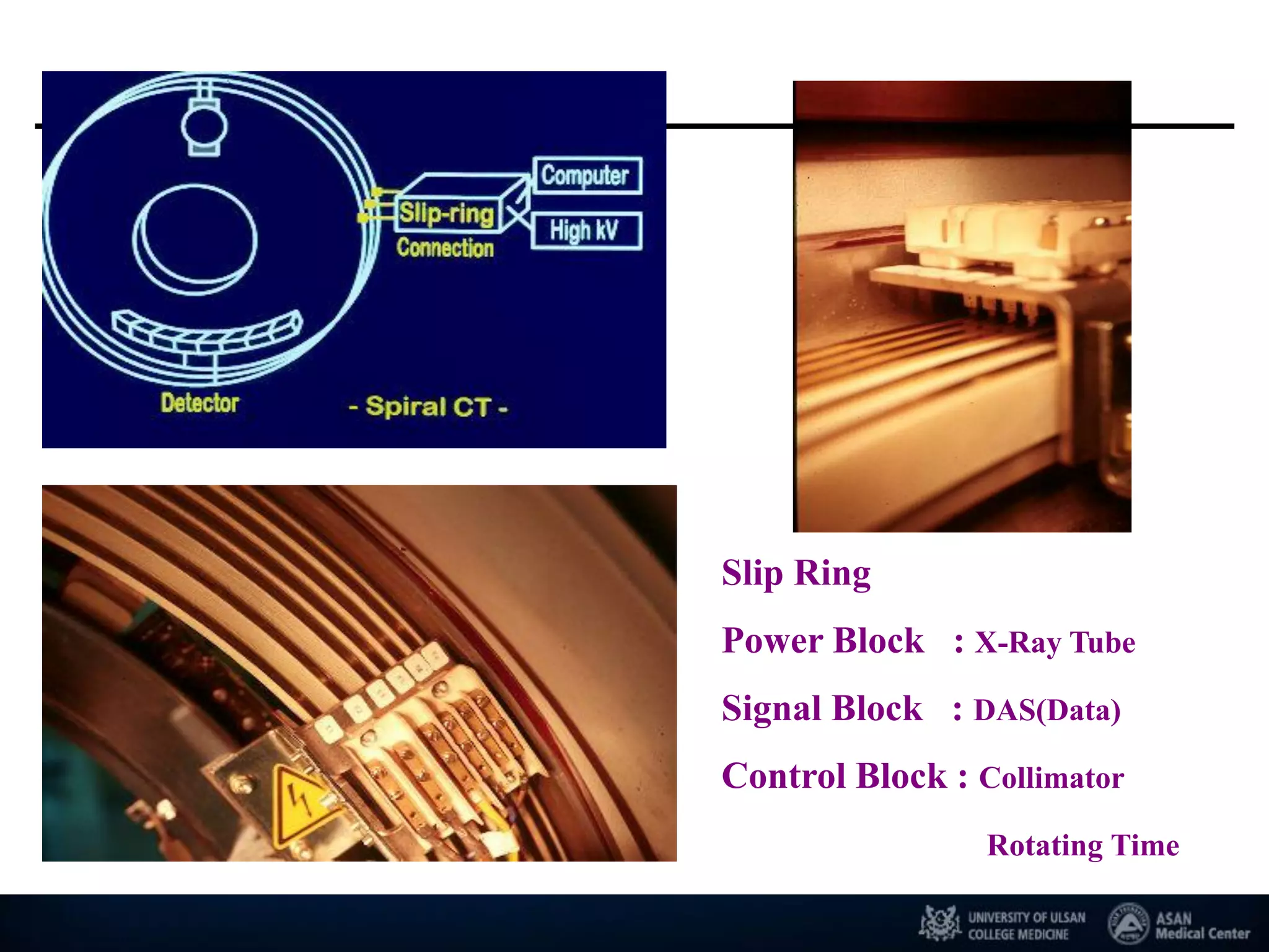 Slip Ring
Power Block : X-Ray Tube
Signal Block : DAS(Data)
Control Block : Collimator
Rotating Time
 
