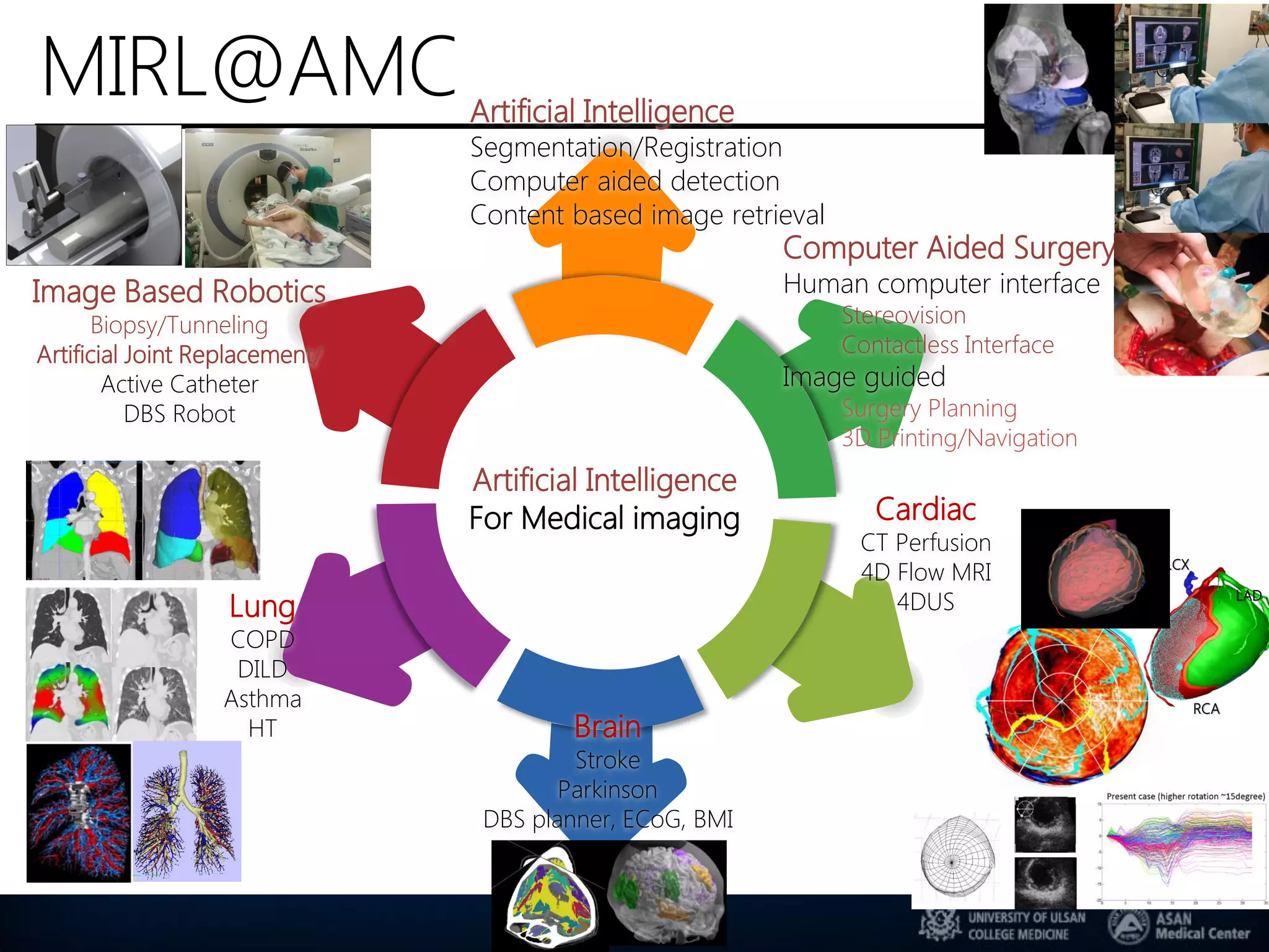 MIRL@AMC
Image Based Robotics
Biopsy/Tunneling
Artificial Joint Replacement/
Active Catheter
DBS Robot
Computer Aided Surgery
Human computer interface
Stereovision
Contactless Interface
Image guided
Surgery Planning
3D Printing/Navigation
Brain
Stroke
Parkinson
DBS planner, ECoG, BMI
Lung
COPD
DILD
Asthma
HT
Cardiac
CT Perfusion
4D Flow MRI
4DUS
LCX
Artificial Intelligence
For Medical imaging
Artificial Intelligence
Segmentation/Registration
Computer aided detection
Content based image retrieval
LAD
RCA
 