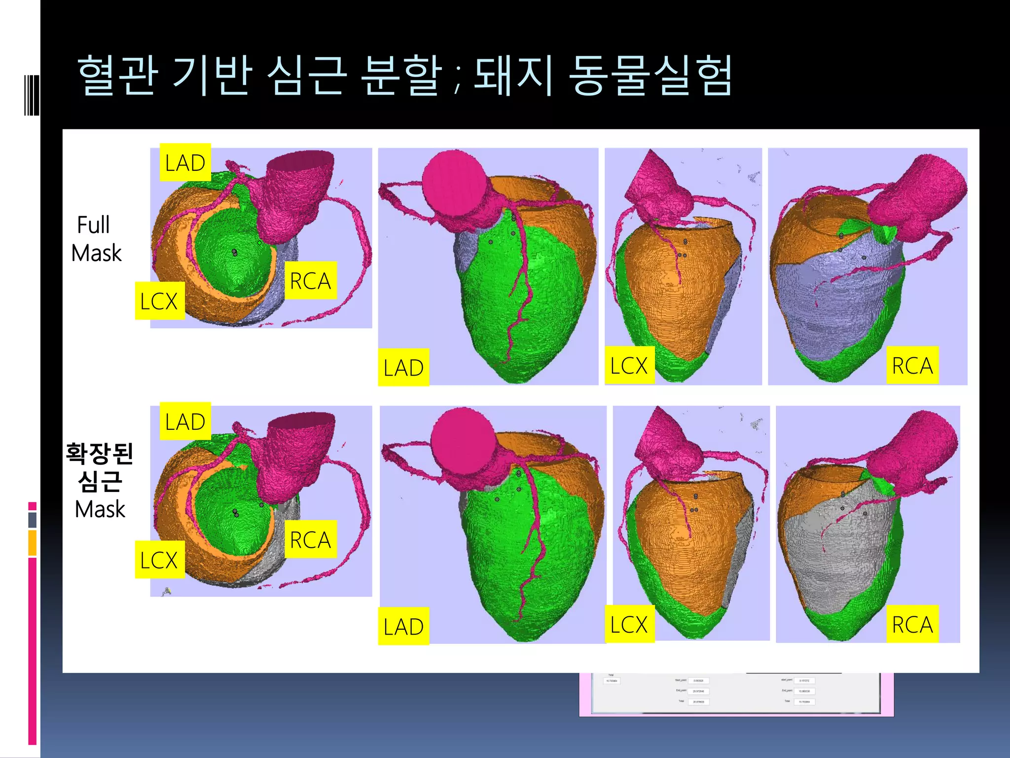 혈관 기반 심근 분할 ; 돼지 동물실험
1-b) CT 영상 capture (size 동일, Target Territory의 Mask 반영)1-a) 병리사진 (Target Territory 마킹)
2) Control Point
지정
(최소 35~40개)
3) Registration
4) 평가
Resizing 필요(Optional: CT Image size에 맞춤)
Left: Pie#0~20
Right: Pie#0~15
중첩: Pie 15개
Start point
LAD
RCA
LCX
Full
Mask
확장된
심근
Mask
LAD LCX RCA
LAD
RCA
LCX
LAD LCX RCA
 