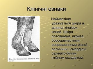 хвороби шкіри | PPT