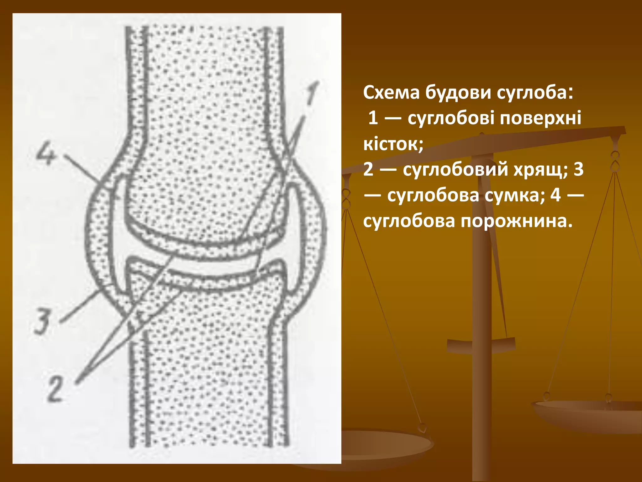 Схема будови суглоба:
1 — суглобові поверхні
кісток;
2 — суглобовий хрящ; 3
— суглобова сумка; 4 —
суглобова порожнина.
 