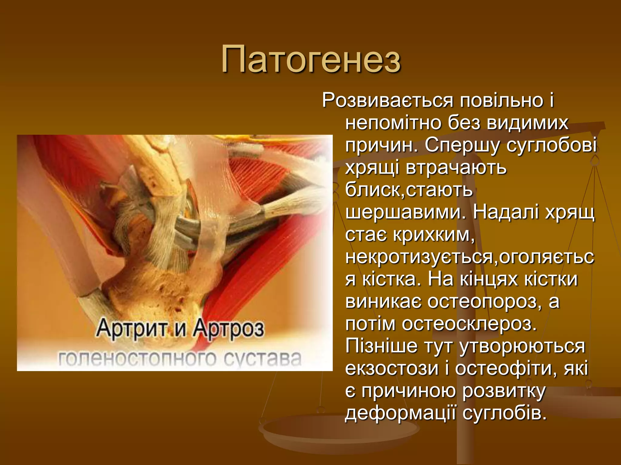 Патогенез
Розвивається повільно і
непомітно без видимих
причин. Спершу суглобові
хрящі втрачають
блиск,стають
шершавими. Надалі хрящ
стає крихким,
некротизується,оголяєтьс
я кістка. На кінцях кістки
виникає остеопороз, а
потім остеосклероз.
Пізніше тут утворюються
екзостози і остеофіти, які
є причиною розвитку
деформації суглобів.
 