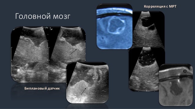 Датчики на мозг