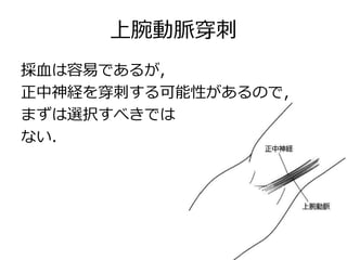 上腕動脈穿刺
採血は容易であるが,
正中神経を穿刺する可能性があるので，
まずは選択すべきでは
ない．
 