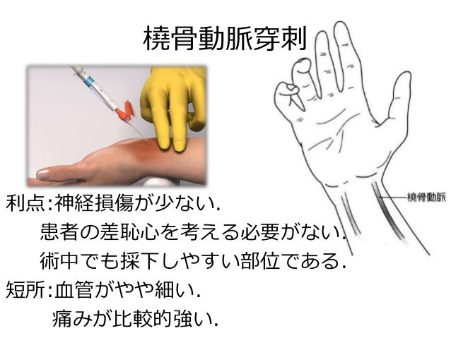 血液ガスのみかた 血液ガスのみかた
