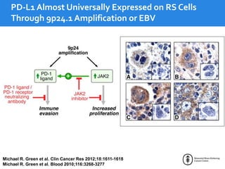Michael R. Green et al. Clin Cancer Res 2012;18:1611-1618
Michael R. Green et al. Blood 2010;116:3268-3277
PD-L1 Almost Universally Expressed on RS Cells
Through 9p24.1 Amplification or EBV
 
