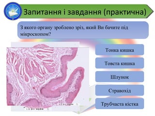 З якого органу зроблено зріз, який Ви бачите під
мікроскопом?
Тонка кишка
Товста кишка
Шлунок
Стравохід
Трубчаста кістка
Запитання і завдання (практична)Запитання і завдання (практична)
 
