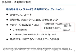 画像認識 x 自動診断の現在
 2016年よりスタート
 領域分割、病変パターン抽出、診断の3タスク
 学習データ構成(2017 ver.)：
 374 melanoma
 254 seborrheic keratosis & 1372 benign nevi
 2017年は、診断でカシオx信州大チームが優勝
悪性黒色腫（メラノーマ）自動診断コンペティション*
11
* D.Gutman et al.: Skin Lesion Analysis toward Melanoma Detection: A Challenge at the International Symposium on
Biomedical Imaging (ISBI) 2016, hosted by the International Skin Imaging Collaboration (ISIC), arXiv:1605.0139, 2016.
- 一般物体認識 (Visual Genome):
108,249枚
- 手書き数字 (MNIST):
50,000枚
 