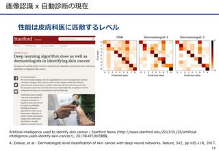 画像認識 x 自動診断の現在
性能は皮膚科医に匹敵するレベル
12
A. Esteva, et al.: Dermatologist-level classification of skin cancer with deep neural networks. Nature, 542, pp.115-118, 2017.
Artificial intelligence used to identify skin cancer | Stanford News (http://news.stanford.edu/2017/01/25/artificial-
intelligence-used-identify-skin-cancer/), 2017年4月28日閲覧.
 