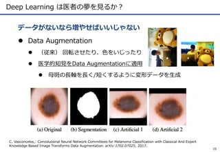 Deep Learning は医者の夢を見るか？
 Data Augmentation
 （従来） 回転させたり、色をいじったり
 医学的知見をData Augmentationに適用
 母斑の長軸を長く/短くするように変形データを生成
データがないなら増やせばいいじゃない
15
C. Vasconcelos,: Convolutional Neural Network Committees for Melanoma Classification with Classical And Expert
Knowledge Based Image Transforms Data Augmentation. arXiv:1702.07025, 2017.
 