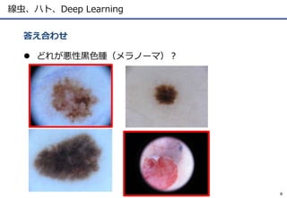 線虫、ハト、Deep Learning
 どれが悪性黒色腫（メラノーマ）？
答え合わせ
8
 
