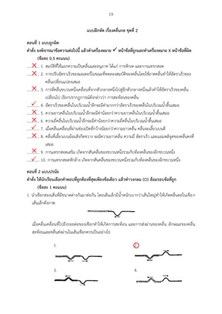 19
แบบฝึกหัด เรื่องคลื่นกล ชุดที่ 2
ตอนที่ 1 แบบถูกผศด
คำสั่ง จงพศจำรณำข้อควำมต่อไปนี แล้วทำเครื่องหมำย  หน้ำข้อที่ถูกและทำเครื่องหมำย X หน้ำข้อที่ผศด
(ข้อละ 0.5 คะแนน)
............. 1. สมบัติที่ใช้แยกความเป็นคลื่นและอนุภาค ได้แก่ การหักเห และการแทรกสอด
............. 2. การปรับอัตราเร็วของมอเตอร์ในขณะที่ทดลองสมบัติของคลื่นโดยใช้ถาดคลื่นทาให้อัตราเร็วของ
คลื่นเปลี่ยนแปลงเสมอ
............. 3. การที่คลื่นขบวนหนึ่งเคลื่อนที่จากตัวกลางหนึ่งไปสู่อีกตัวกลางหนึ่งแล้วทาให้อัตราเร็วของคลื่น
เปลี่ยนไป เรียกปรากฏการณ์ดังกล่าวว่า การสะท้อนของคลื่น
............. 4. อัตราเร็วของคลื่นในบริเวณน้าลึกจะมีค่ามากกว่าอัตราเร็วของคลื่นในบริเวณน้าตื้นเสมอ
............. 5. ความยาวคลื่นในบริเวณน้าลึกจะมีค่าน้อยกว่าความยาวคลื่นในบริเวณน้าตื้นเสมอ
............. 6. ความถี่คลื่นในบริเวณน้าลึกจะมีค่าน้อยกว่าความถี่คลื่นในบริเวณน้าตื้นเสมอ
............. 7. เมื่อคลื่นเคลื่อนที่ผ่านช่องเปิดที่กว้างน้อยกว่าความยาวคลื่น คลื่นจะเลี้ยวเบนดี
............. 8. คลื่นที่เลี้ยวเบนอ้อมสิ่งกีดขวาง จะมีความยาวคลื่น ความถี่ อัตราเร็ว และแอมพลิจูดของคลื่นคงที่
เสมอ
............. 9. การแทรกสอดเสริม เกิดจากสันคลื่นของขบวนหนึ่งรวมกับท้องคลื่นของอีกขบวนหนึ่ง
............. 10. การแทรกสอดหักล้าง เกิดจากสันคลื่นของขบวนหนึ่งรวมกับท้องคลื่นของอีกขบวนหนึ่ง
ตอนที่ 2 แบบปรนัย
คำสั่ง ให้นักเรียนเลือกคำตอบที่ถูกต้องที่สุดเพียงข้อเดียว แล้วทำวงกลม (O) ล้อมรอบข้อที่ถูก
(ข้อละ 1 คะแนน)
1. นาเชือกสองเส้นที่มีขนาดต่างกันมาต่อกัน โดยเส้นเล็กมีน้าหนักเบากว่าเส้นใหญ่ทาให้เกิดคลื่นดลในเชือก
เส้นเล็กดังภาพ
เมื่อคลื่นเคลื่อนที่ไปถึงรอยต่อของเชือกทาให้เกิดการสะท้อน และการส่งผ่านของคลื่น ลักษณะของคลื่น
สะท้อนและคลื่นส่งผ่านในเส้นเชือกควรเป็นอย่างไร
1. 2.
3. 4.











 